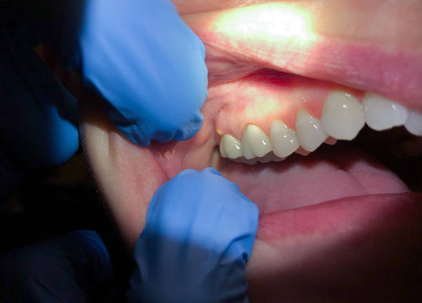 Emergency Dental Services for Seniors